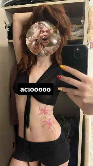 Xokitt0n OnlyFans Leaked Free Thumbnail Picture - #QUEHBCMtsO