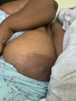 Yoshii Bbw OnlyFans Leaked Free Thumbnail Picture - #aVJQF6K2wU