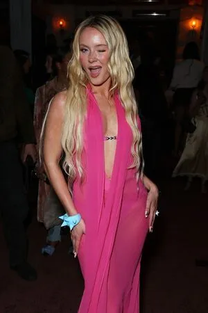 Zara Larsson OnlyFans Leaked Free Thumbnail Picture - #v6FFrxahvJ